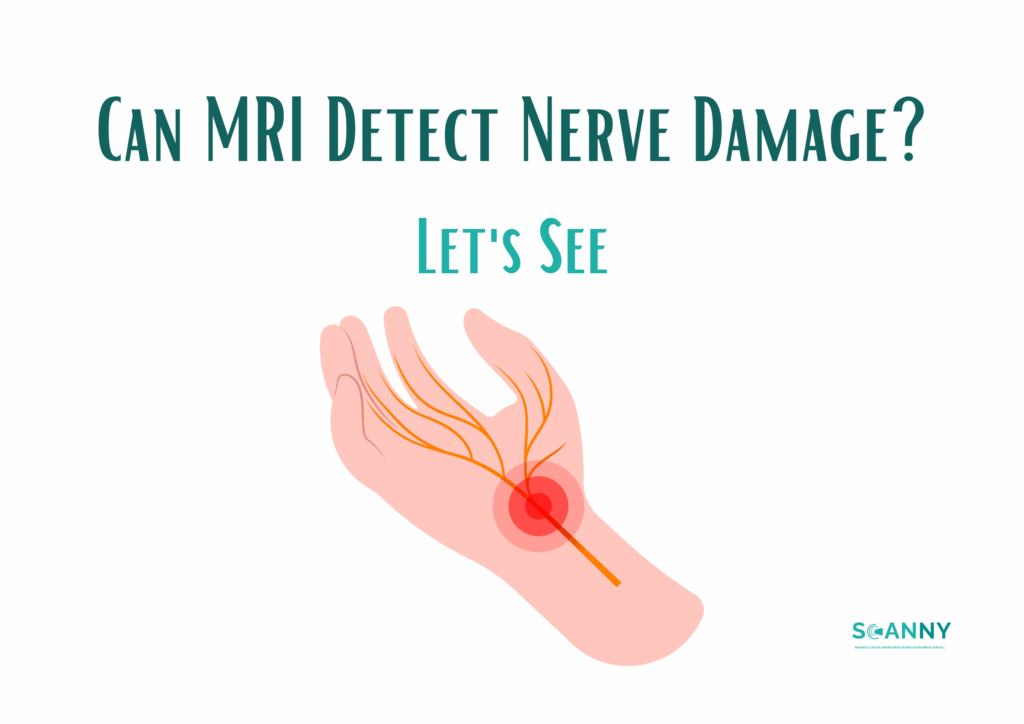 Can MRI Detect Nerve Damage