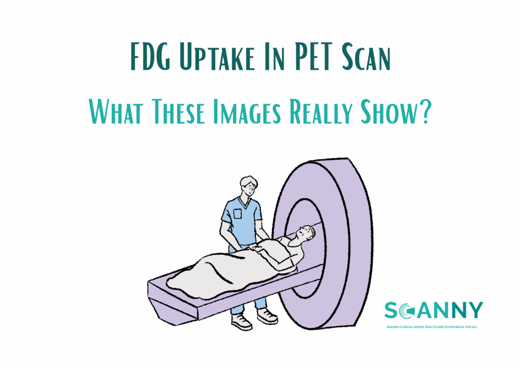 FDG Uptake in PET Scan