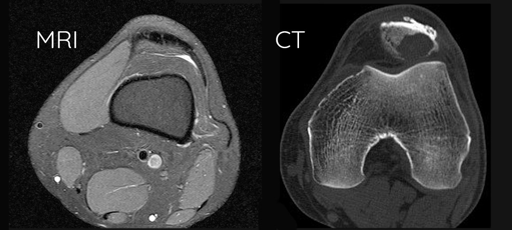 Are CT scans safer than MRI?