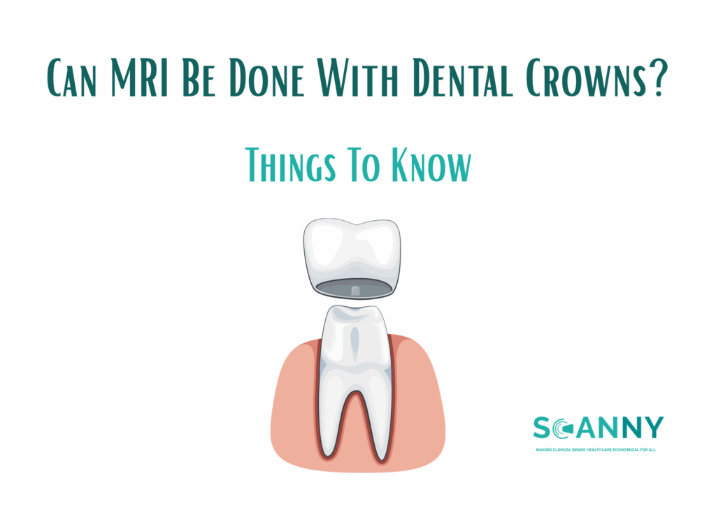 Can MRI Be Done With Dental Crowns