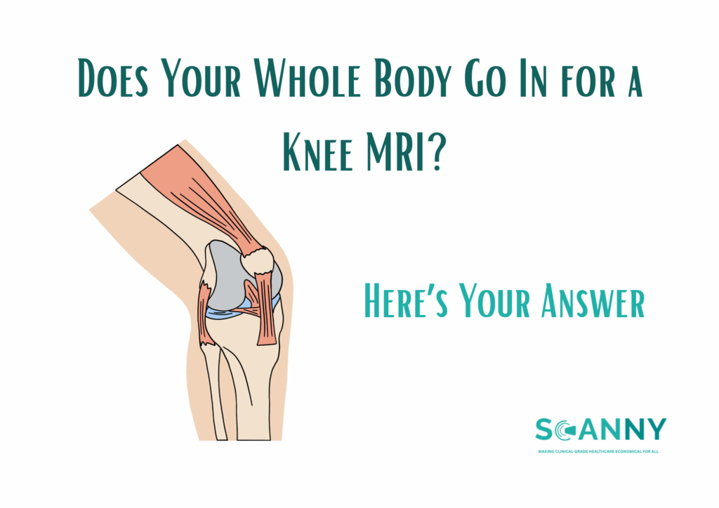 Does Your Whole Body Go In for a Knee MRI