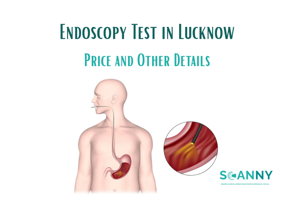 Endoscopy Test in Lucknow